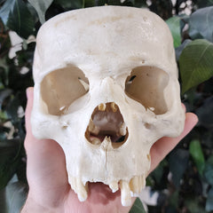 Human Skull, Tooth In Nose (Ex-Museum)