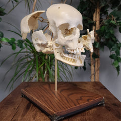 Exploded Human Skull, Beauchene (Collapsible)