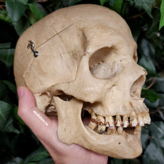 Human Skull, Overbite