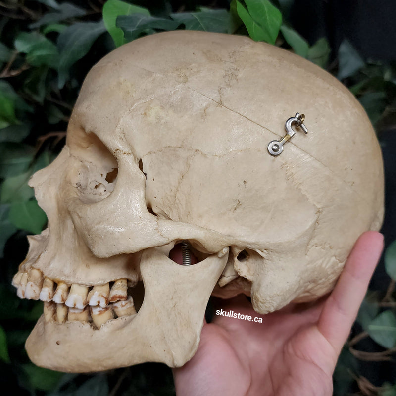 Human Skull, Overbite