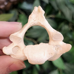 Human Axis Vertebrae
