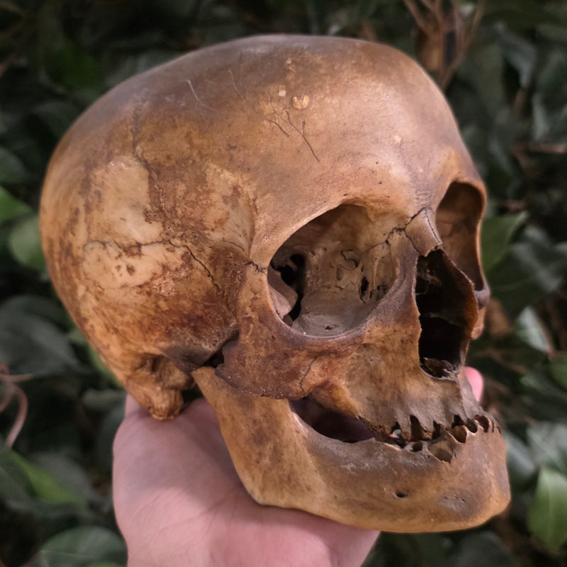 Toulouse Elongated Skull Medieval Ex Museum SkullStore Inc toulouse-elongated-skull-medieval-ex-museum-skullstore-inc