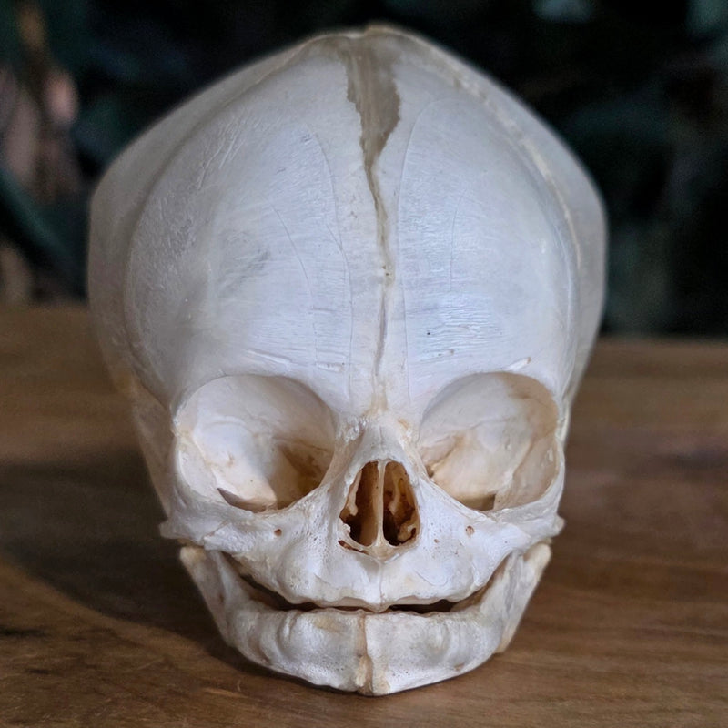 Human Fetal Skull (Ex-Museum)