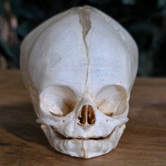 Human Fetal Skull (Ex-Museum)