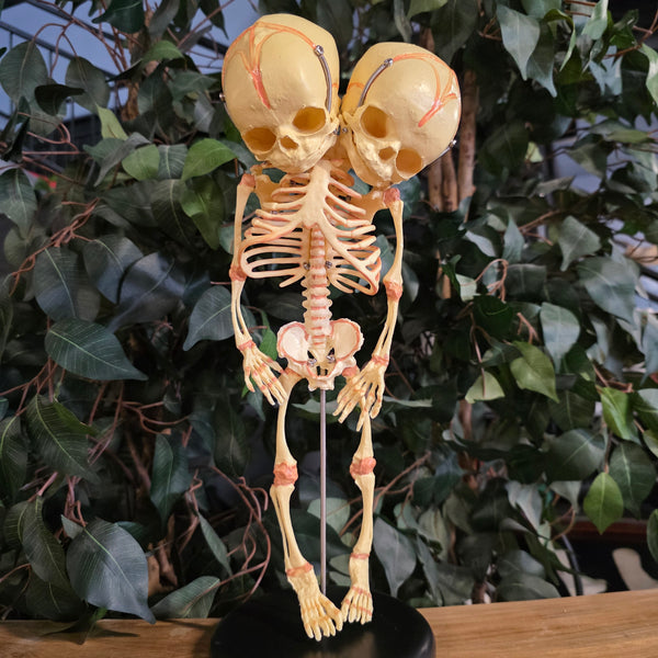 Two-Headed Human Fetal Skeleton (CAST) | SkullStore Inc.