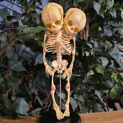 Two-Headed Human Fetal Skeleton (CAST)