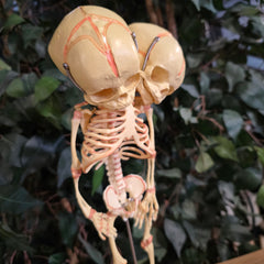 Two-Headed Human Fetal Skeleton (CAST)