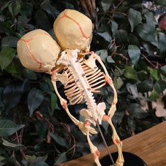 Two-Headed Human Fetal Skeleton (CAST)