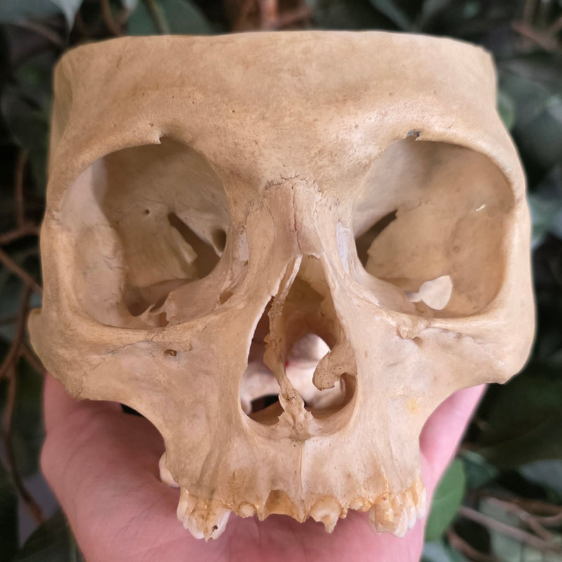 Human Skull, Medical B