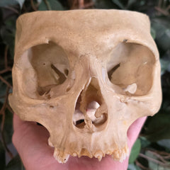 Human Skull, Medical B