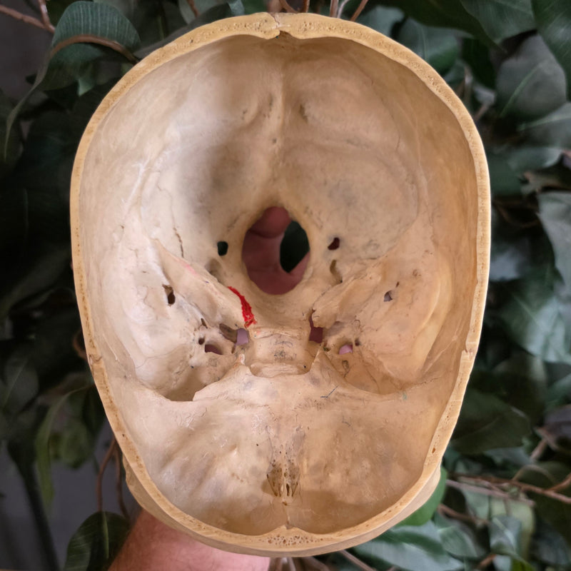 Human Skull, Medical B