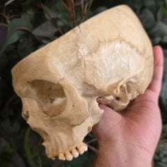 Human Skull, Medical B