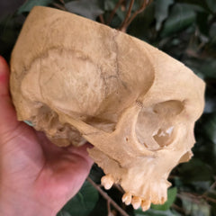 Human Skull, Medical B