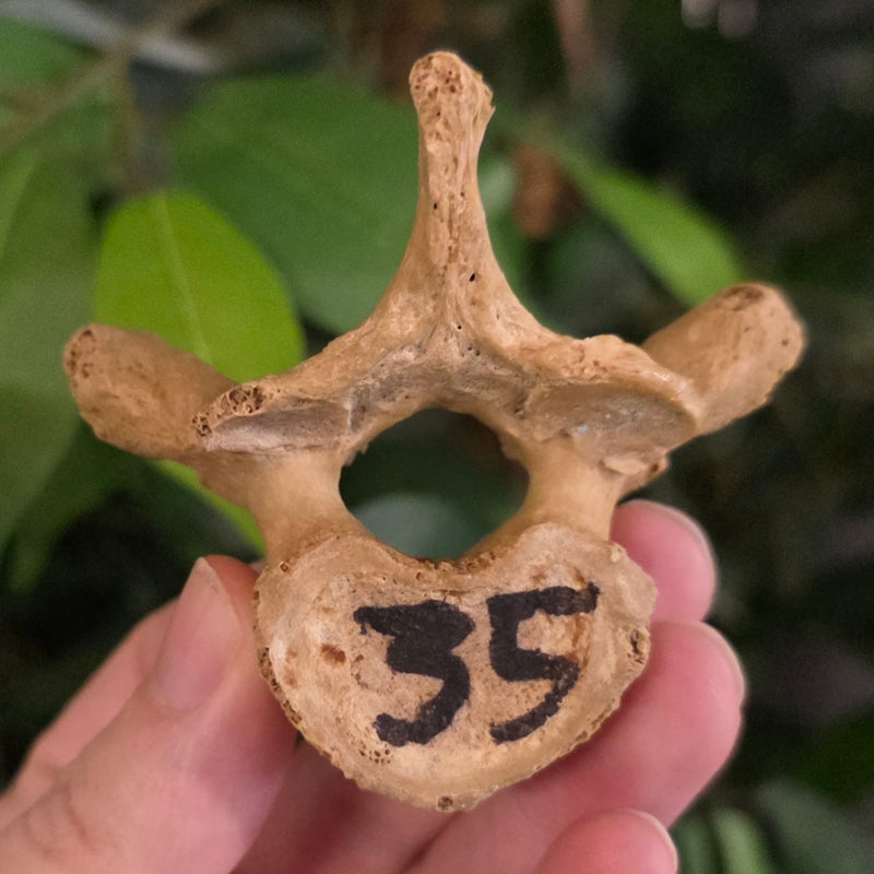 Human Vertebrae B