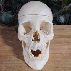 Human Skull, Medical F (Underbite)