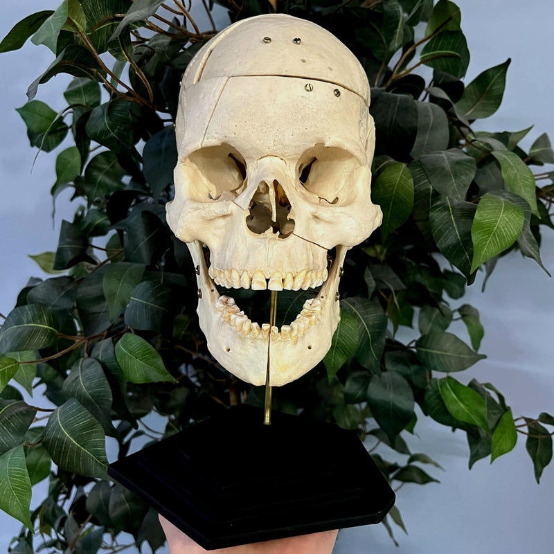 Exploded Human Skull, Beauchene (Collapsible)
