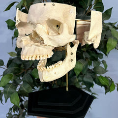 Exploded Human Skull, Beauchene (Collapsible)