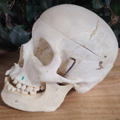 Human Skull, Medical D
