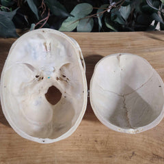 Human Skull, Medical D