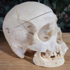 Human Skull, Medical C