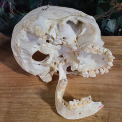 Human Skull, Medical C