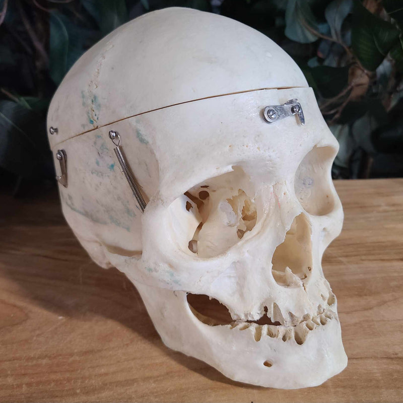 Human Skull, Medical A (Bisected)