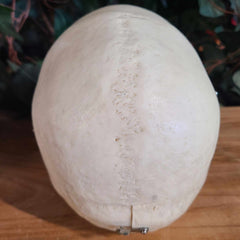 Human Skull, Medical A (Bisected)