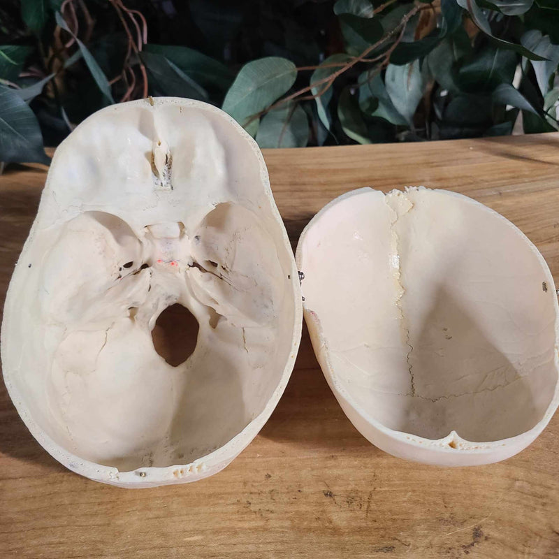 Human Skull, Medical F (Underbite)