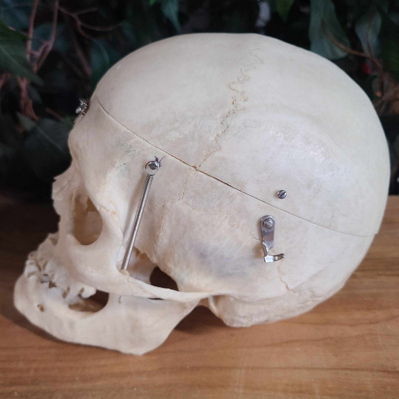 Human Skull, Medical A (Bisected)