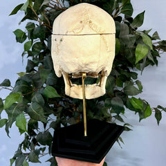 Exploded Human Skull, Beauchene (Collapsible)