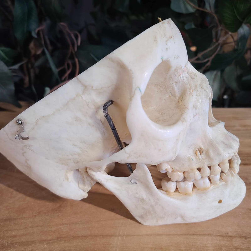 Human Skull, Medical G