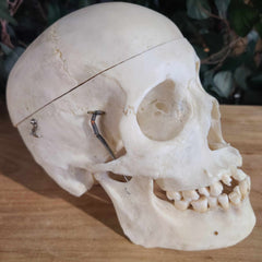 Human Skull, Medical D