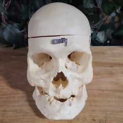 Human Skull, Medical E (Bisected, Underbite)
