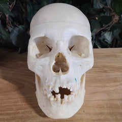 Human Skull, Medical D