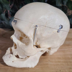 Human Skull, Medical E (Bisected, Underbite)