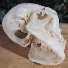 Human Skull, Medical D