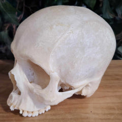 Human Skull, Medical B