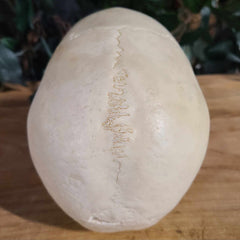 Human Skull, Medical F (Underbite)