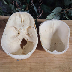 Human Skull, Medical E (Bisected, Underbite)