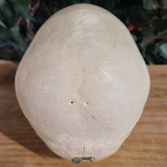 Human Skull, Medical E (Bisected, Underbite)