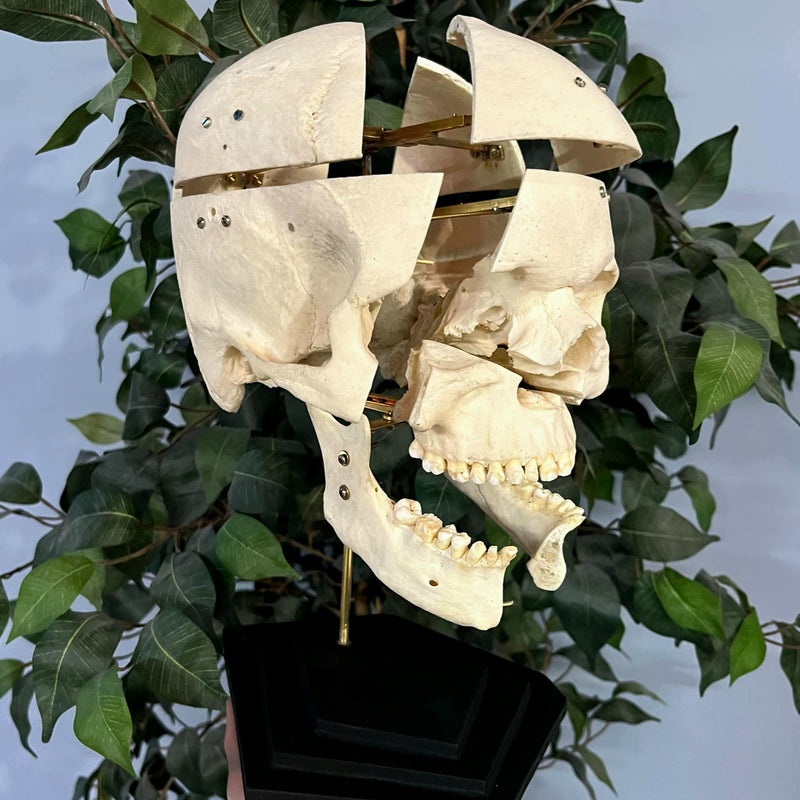 Exploded Human Skull, Beauchene (Collapsible)