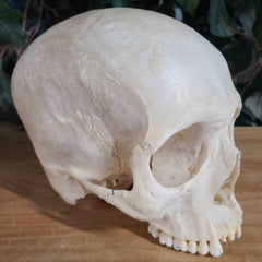 Human Skull, Medical B