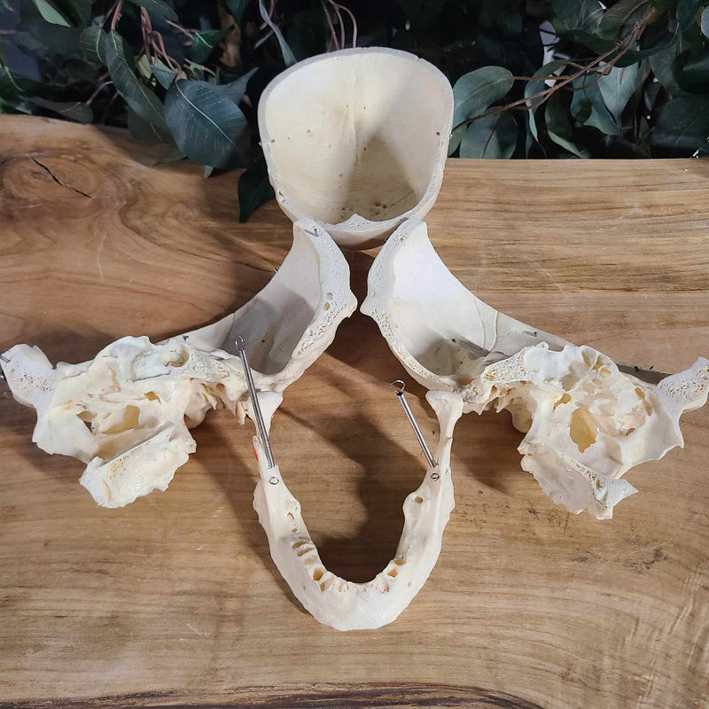 Human Skull, Medical E (Bisected, Underbite)