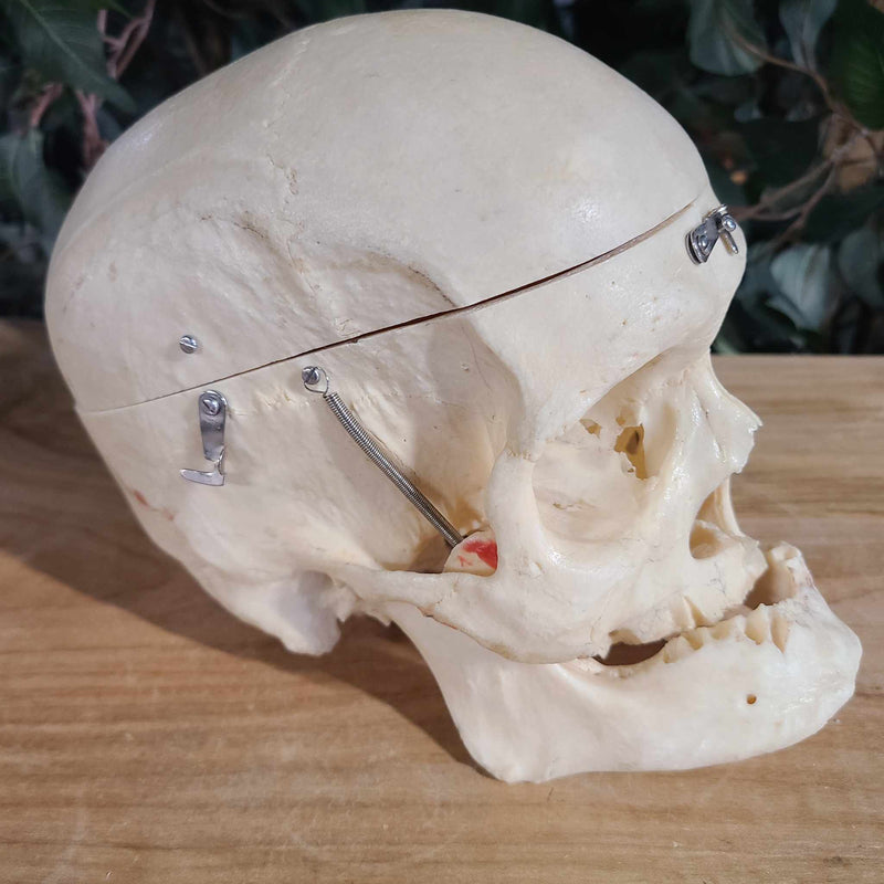 Human Skull, Medical E (Bisected, Underbite)