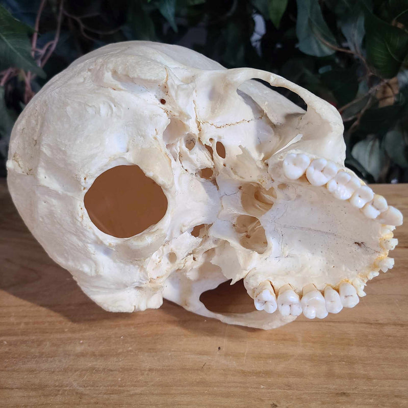 Human Skull, Medical B