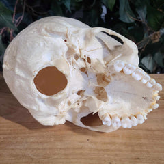 Human Skull, Medical B