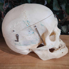 Human Skull, Medical A (Bisected)
