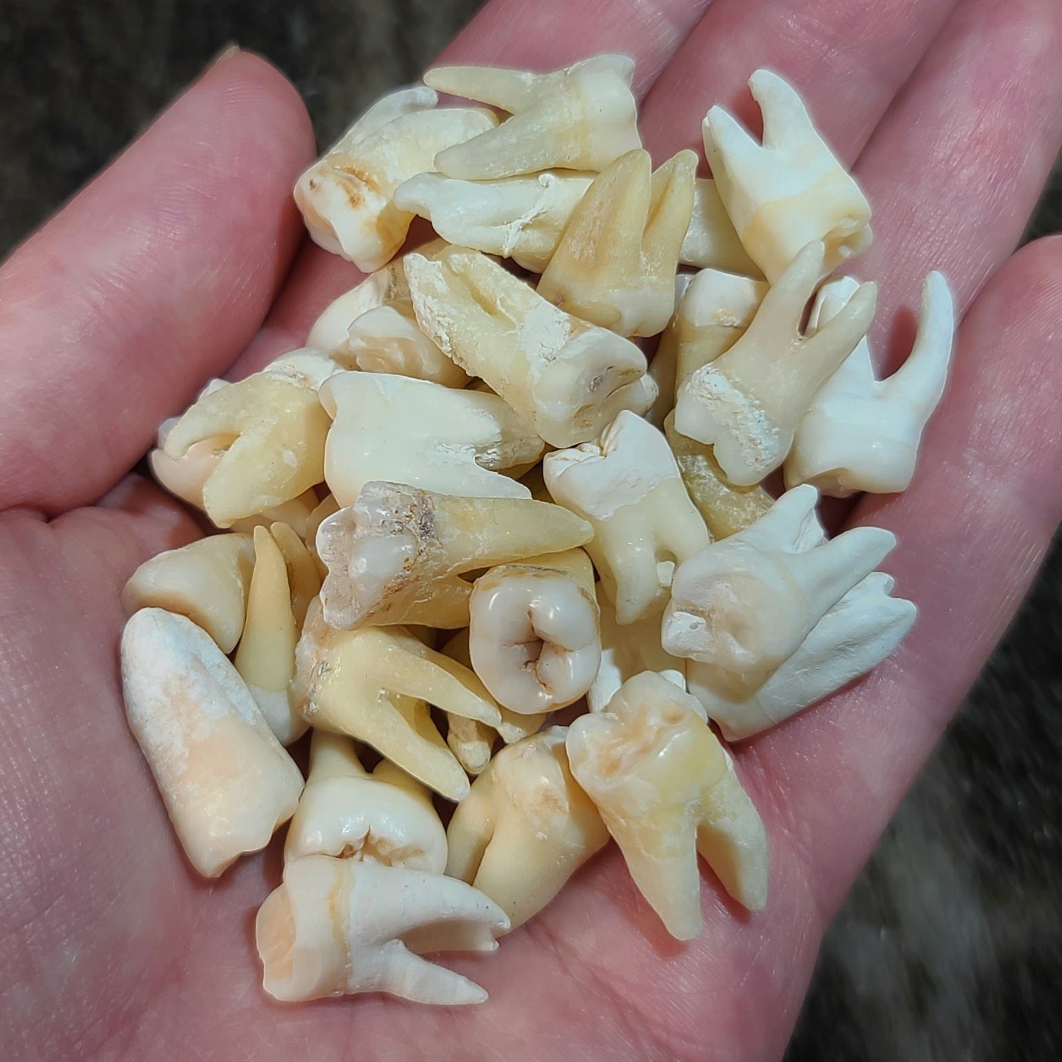 Real Human Teeth