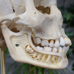 Exploded Human Skull, Beauchene (Collapsible)