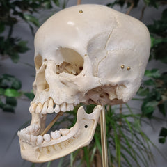 Exploded Human Skull, Beauchene (Collapsible)